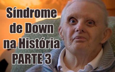 Síndrome de Down na História – parte 3