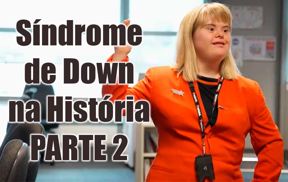 Síndrome de Down na História – parte 2