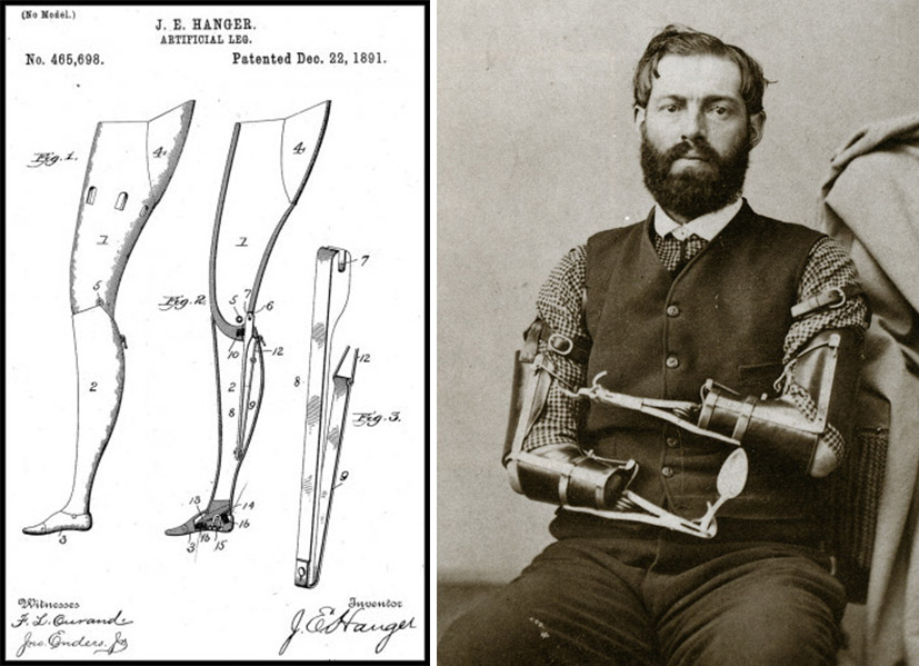 History of War and Prosthetics (6)