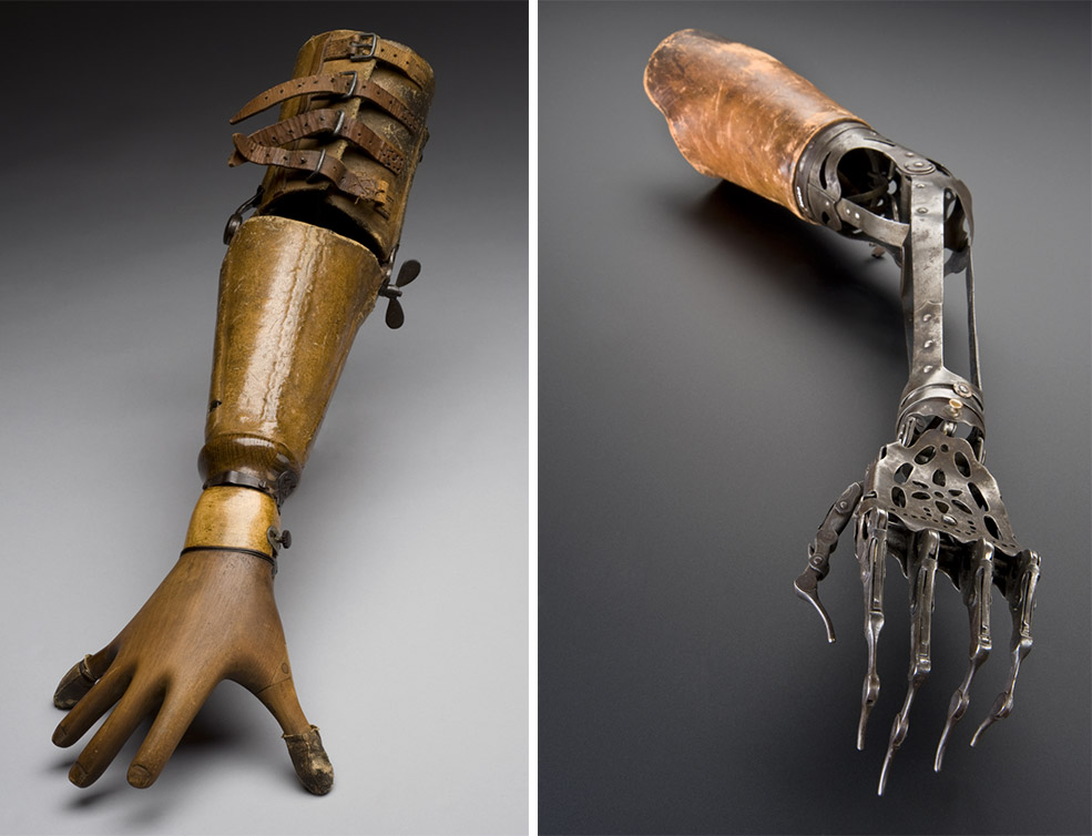 History of War and Prosthetics (7)